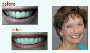 Ventura Smile smile gallery before and afters thanks to Dr. Fisch, Dr. Mizraji and Dr. Chang